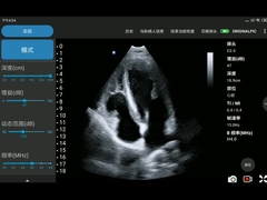 3.6MHz φορητός ασύρματος έλεγχος υπερήχου που συγχρονίζεται - μετατροπέας σειράς