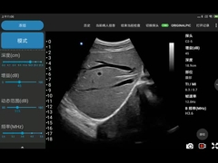 Ηλεκτρονική κυρτή συσκευή υπερήχου σειράς ασύρματη για το κινητό τηλέφωνο