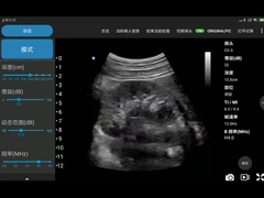 Χαρακτηρισμένο CE BMP PNG mpeg-4 ανιχνευτών JPEG υπερήχου 3.6MHz φορητό Wifi