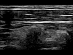 WiFi 12.6cm μακρινή φορητή μηχανή 30 υπερήχου Doppler Fps