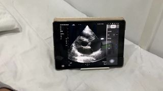 Ασύρματο ανιχνευτή υπερήχων διπλής κεφαλής για Cardiac και POCUS