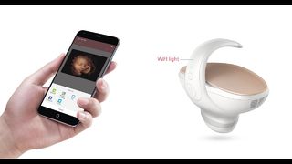 Marvoto Fetus Camera M1- 3D Handheld Ultrasound