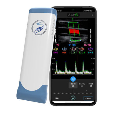 Αγορά Ασύρματος φορητός σαρωτής υπερήχων 12 MHz για iPhone & iPad | Ηλεκτρονικός γραμμικός ανιχνευτής έγχρωμου Doppler online manufacture