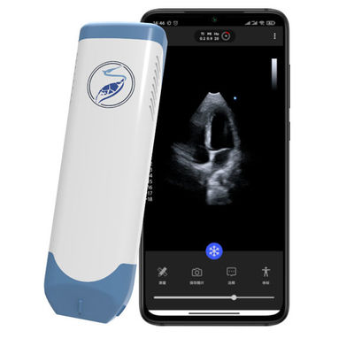 Αγορά Ασύρματο Phased Array Handheld Ultrasound Scanner 5MHz Pocket Cardiac Ultrasound for POCUS Echocardiography online manufacture