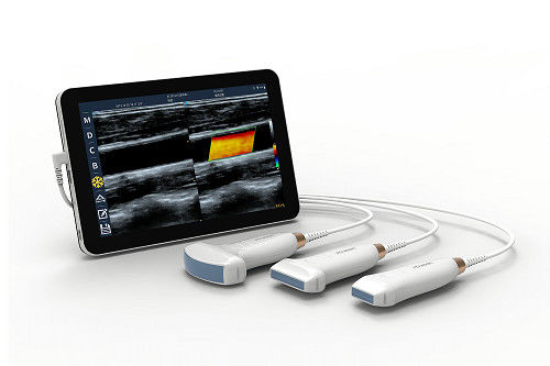 Αγορά USB Type-C Linear Handheld Ultrasound Scanner 10MHz Φορητός ανιχνευτής υπερήχων Android για αγγεία και POCUS online manufacture