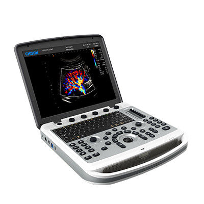 Αγορά 120° περιστρέψιμο Chison SonoBook 6 φορητή μηχανή υπερήχου lap-top online manufacture
