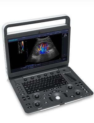 Αγορά 15.6inch υπέρηχος bw μηχανών υπερήχου Sonoscape E1 Exp των οδηγήσεων online manufacture