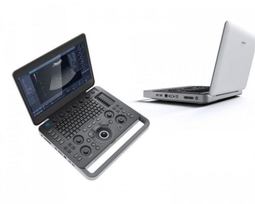 Αγορά Έξυπνη μηχανή υπερήχου SonoScape lap-top θέας 500GB με 15,6» LCD online manufacture