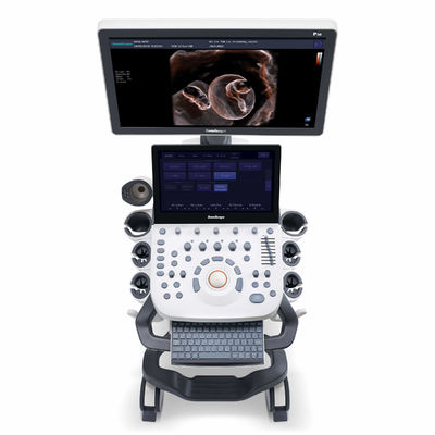 Αγορά μηχανή υπερήχου 4D Elastography SonoScape για OB και τη γυναικολογία online manufacture