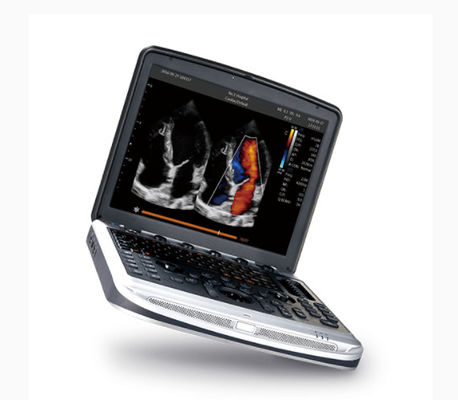 Αγορά Εγκεκριμένη FDA μηχανή Chison SonoBook 8 υπερήχου lap-top για Echocardiography online manufacture