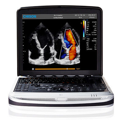 Αγορά Εύκολος να φέρει 4D Chison SonoBook 9 μηχανή υπερήχου lap-top online manufacture