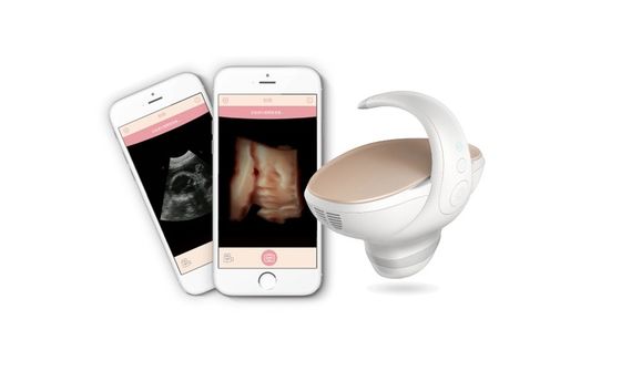 Αγορά Εγκεκριμένος CE 3D/4D φορητός σαρωτής εμβρυϊκού υπερήχουΦορητό διάλυμα απεικόνισης εγκυμοσύνης με κυρτό ανιχνευτή ευρείας γωνίας 60° online manufacture