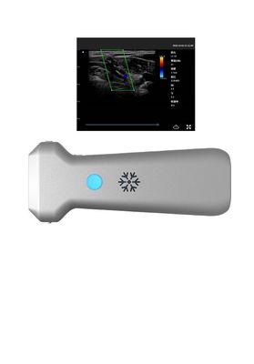 Αγορά 8.3MHz ασύρματο βάθος 12.6cm ελέγχων υπερήχου γραμμικός υπέρηχος ελέγχων online manufacture
