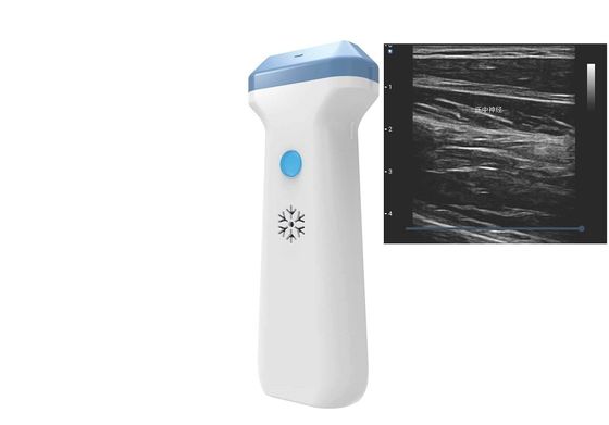 Αγορά BMP PNG JPEG 128 έλεγχος 80 To180dB DICOM υπερήχου Wifi στοιχείων online manufacture
