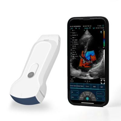 Αγορά Φορητός σαρωτής υπερήχων χειρός IPad POCUS για κλινική διάγνωση online manufacture