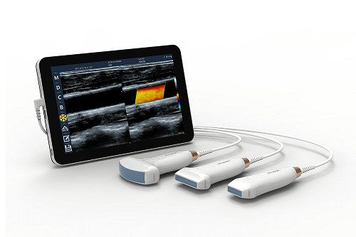 USB Type-C Linear Handheld Ultrasound Scanner 10MHz Φορητός ανιχνευτής υπερήχων Android για αγγεία και POCUS