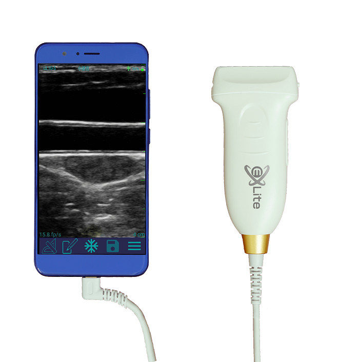 USB Type-C Linear Handheld Ultrasound Scanner 10MHz Φορητός ανιχνευτής υπερήχων Android για αγγεία και POCUS