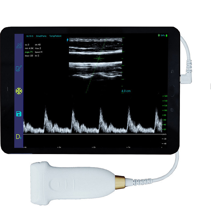 USB Type-C Linear Handheld Ultrasound Scanner 10MHz Φορητός ανιχνευτής υπερήχων Android για αγγεία και POCUS
