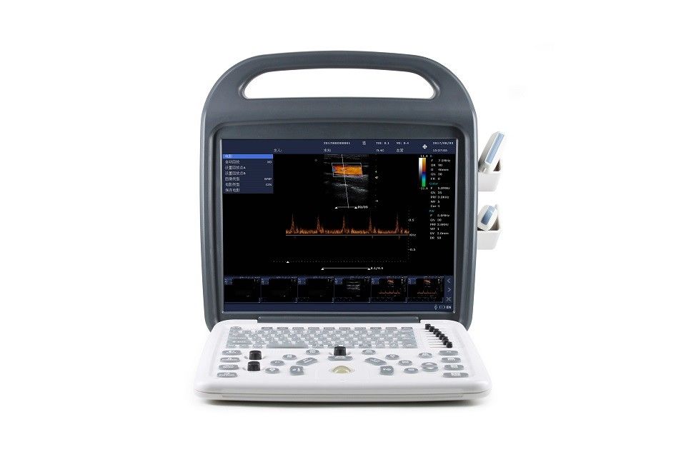 15» υψηλή μηχανή φορητό 7.5kg υπερήχου Doppler χρώματος οργάνων ελέγχου καθορισμού LCD
