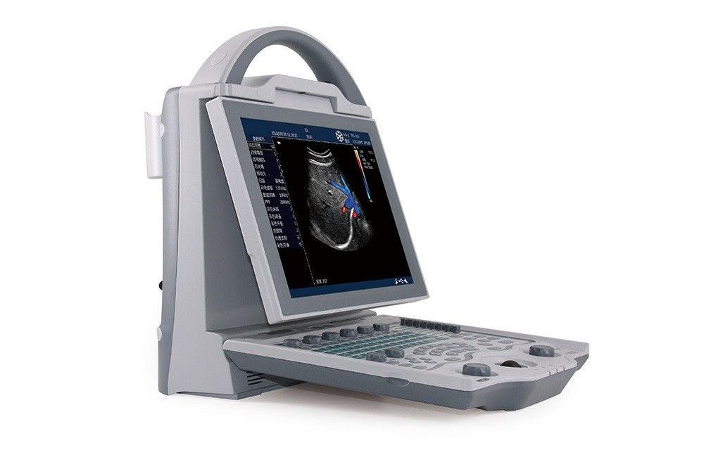 16GB σύστημα υπερήχου Doppler χρώματος lap-top βαθμολογιών εισαγωγής 2$ο για την εγκυμοσύνη