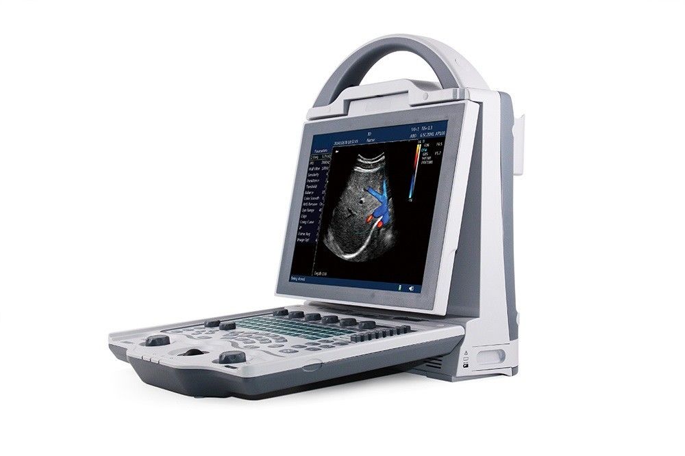 16GB σύστημα υπερήχου Doppler χρώματος lap-top βαθμολογιών εισαγωγής 2$ο για την εγκυμοσύνη